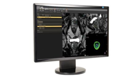 DynaCAD Urology Integrated planning for fusion biopsy