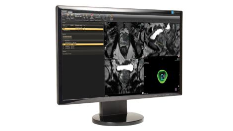 DynaCAD Urology Integrated planning for fusion biopsy and ablation