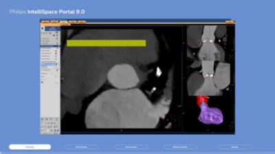 IntelliSpace Portal 9.0 | Radiology and cardiology diagnostic ...