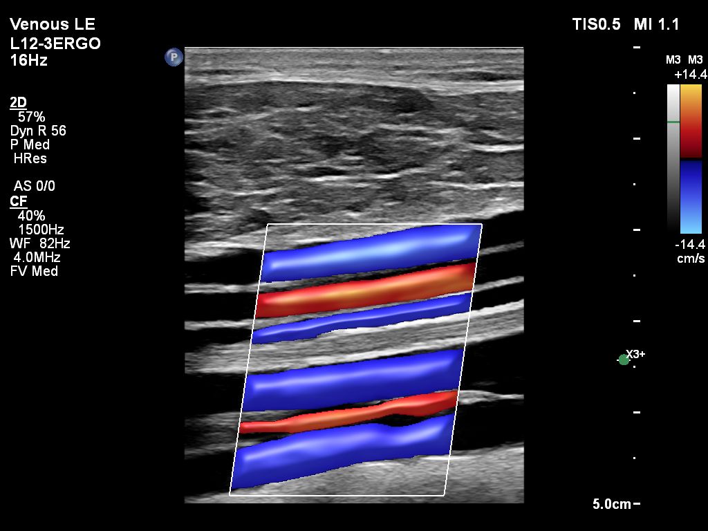 L12-3ERGO EPIQ Venous LE PTV and PER Color