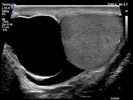L12-5 Testicular Imaging