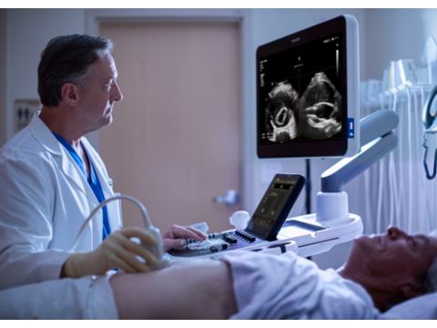 Ultrasound web FlexVue