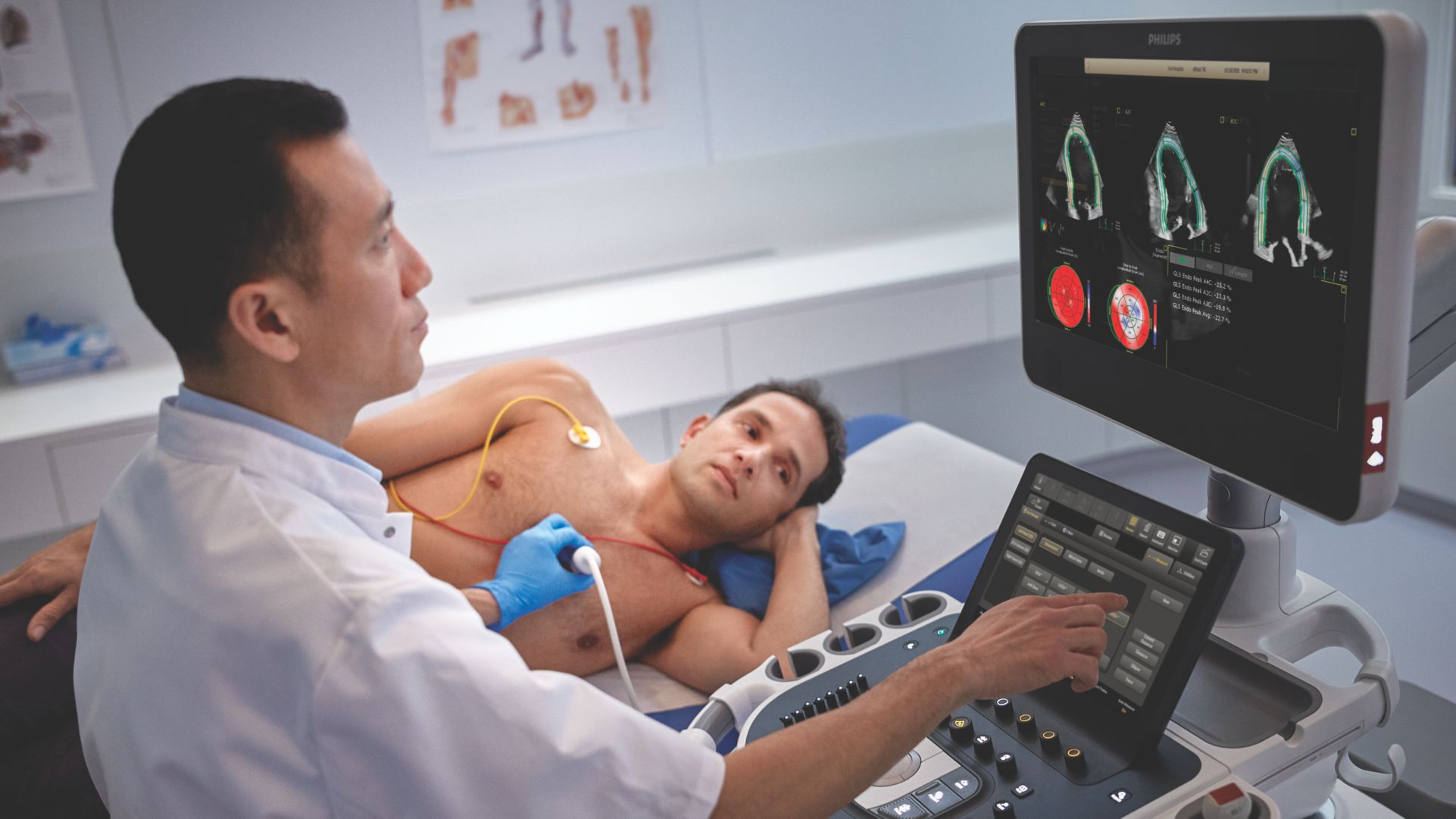 EPIQ CVx using X5-1 AutoStrain 