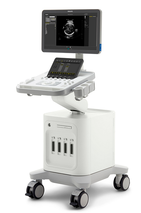 Philips Ultrasound 3300 Ultrasound system