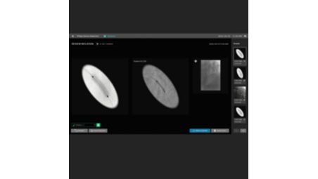 Device Detection/Vessel Enhancement