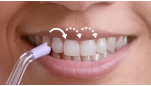 Impulsinės srovės technologija nukreipia nuo danties prie danties.