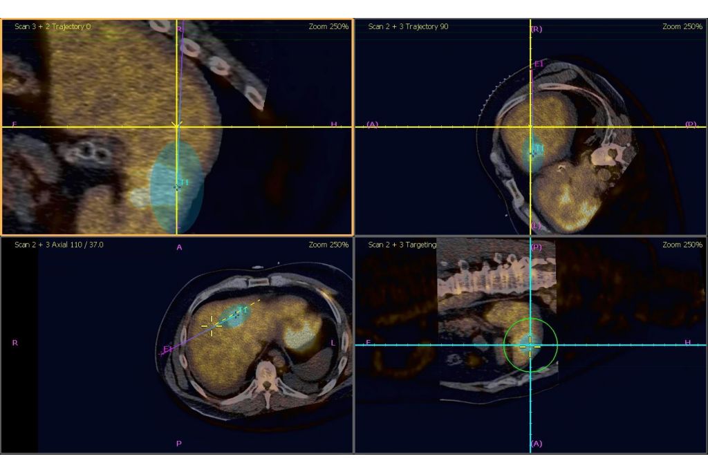 Navigation using PET/CT