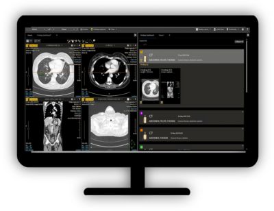 Philips - Zero Footprint Viewer NICA168 - Philips