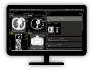 Zero Footprint Viewer Access to advanced DICOM viewing anywhere