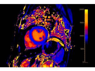 Cardiac Motion Correction Automated motion correction for cardiac MR