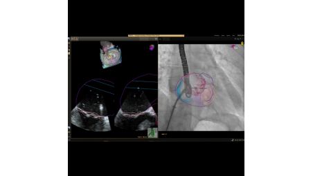 Create 3D segmentation models of the heart