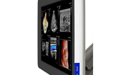 24" HD MAX display