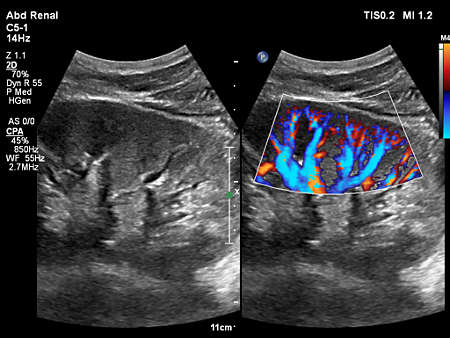 C5-1 Renal Kidney Imaging
