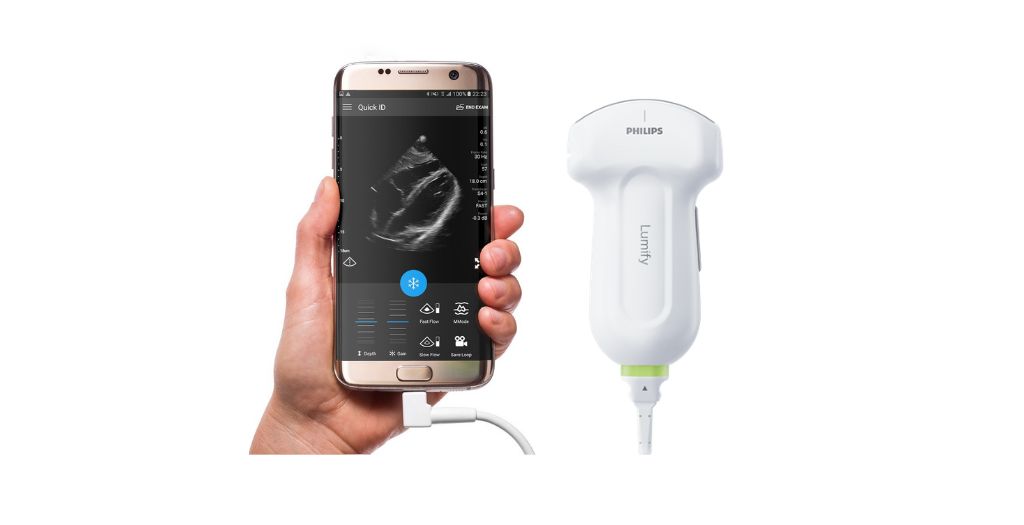 Exceptional clarity at the Point of Care (Lumify Android)