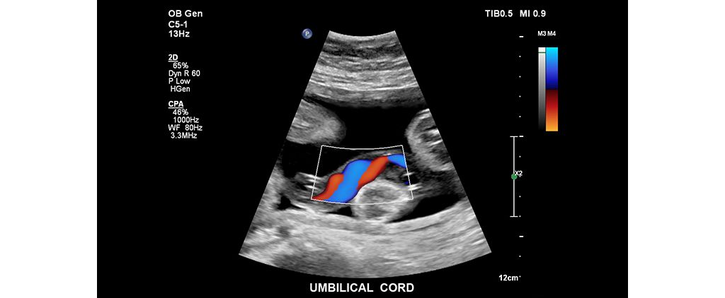 Umbilical cord