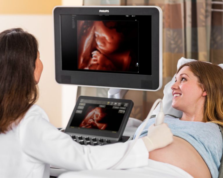 Woman receiving OB ultrasound scan using TrueVue with TouchVue
