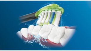 Philips Sonicare'i täiustatud Sonic-tehnoloogia