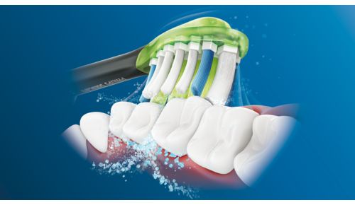 Philips Sonicare's advanced sonic technology