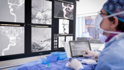 Clinician using Philips Azurion image guided therapy system to view cerebral angiography images