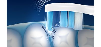 По-добро почистване в трудно достъпните зони от ръчна четка за зъби