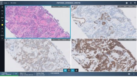 Boosted tissue analysis