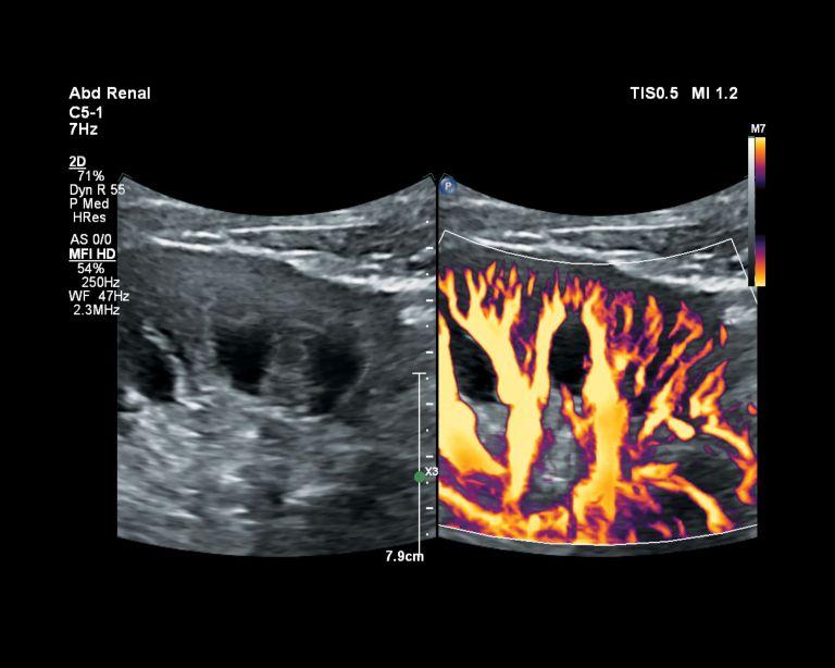 MicroFlow Imaging 