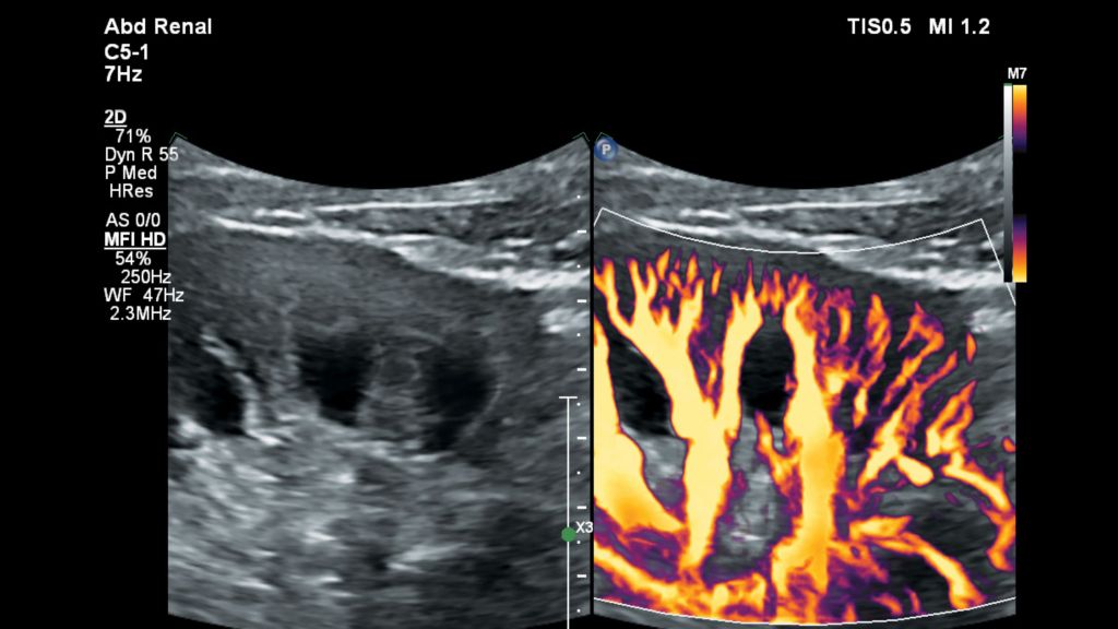 Kidney image