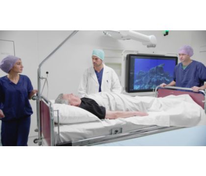 Philips SmartCT in stroke