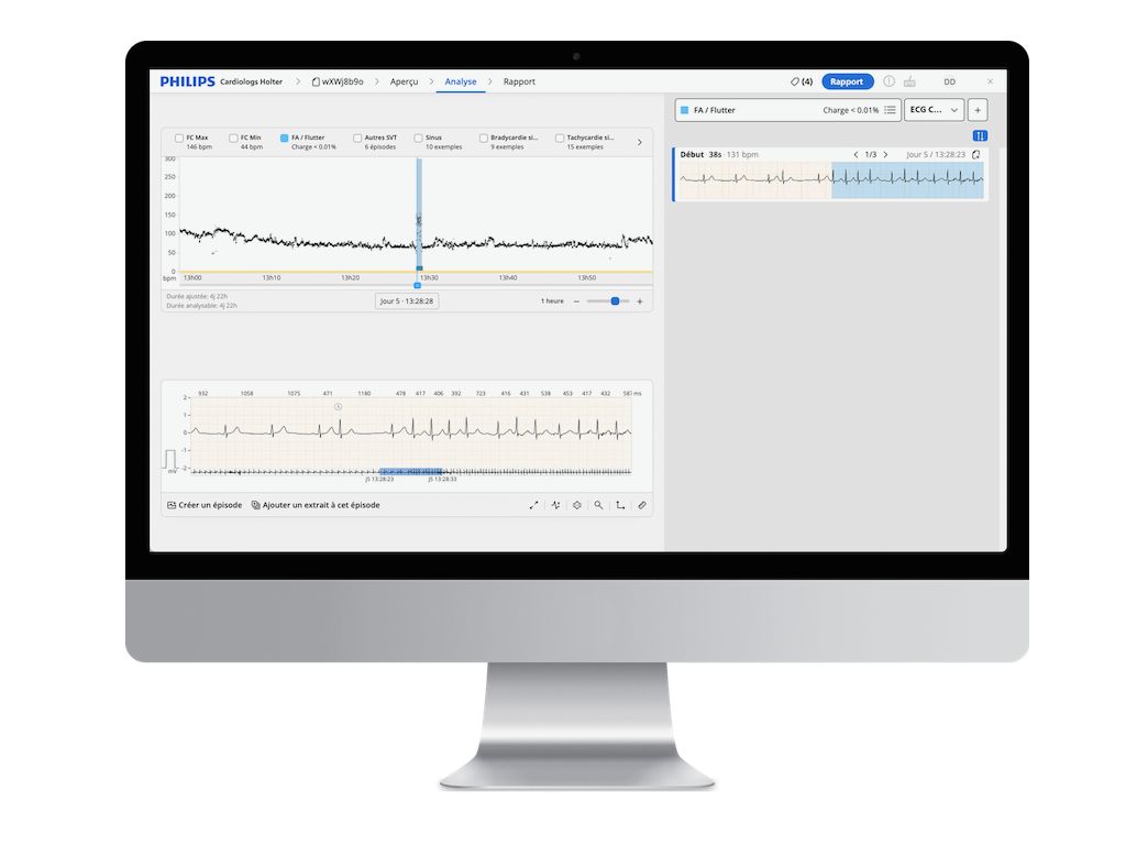 Cardiologs Predict AF Holter