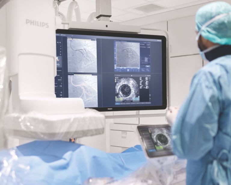 Azurion with iFR co-registration SyncVision