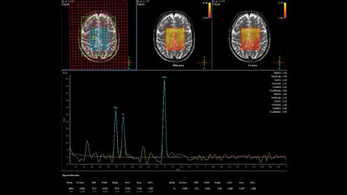 Spectroscopy Imaging