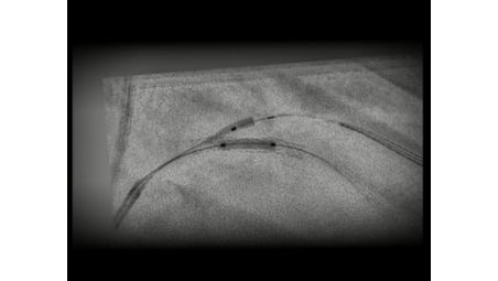 Clinical demands are getting more specific. So are we. 