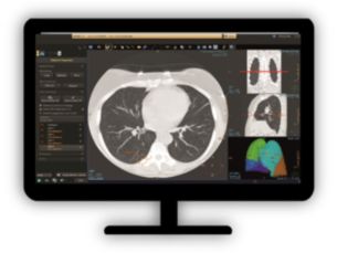 CT Lung Nodule analysis ClearRead CAD Perform nodule search faster and detect previously missed actionable nodules