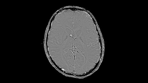 Axial SWIp (Phase)