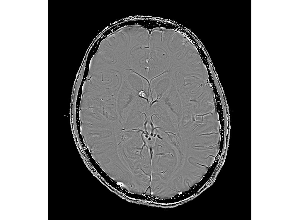 Axial SWIp (Phase)