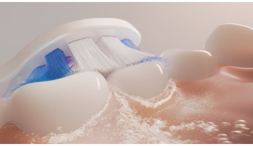 Tecnologia Sonicare comprovata