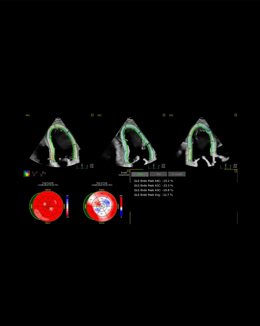 Echo auto strain AI software application interface