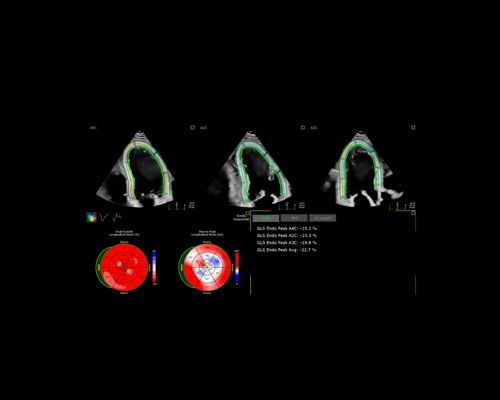 Ultrasound, application, ai, cfq, color flow quantification