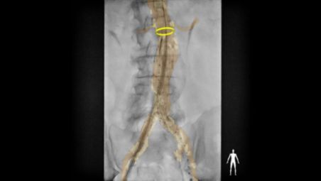 Okrągłe znaczniki obszarów anatomicznych