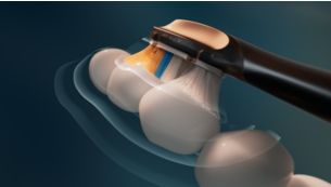 Automatically adjusts based on your brushing behavior