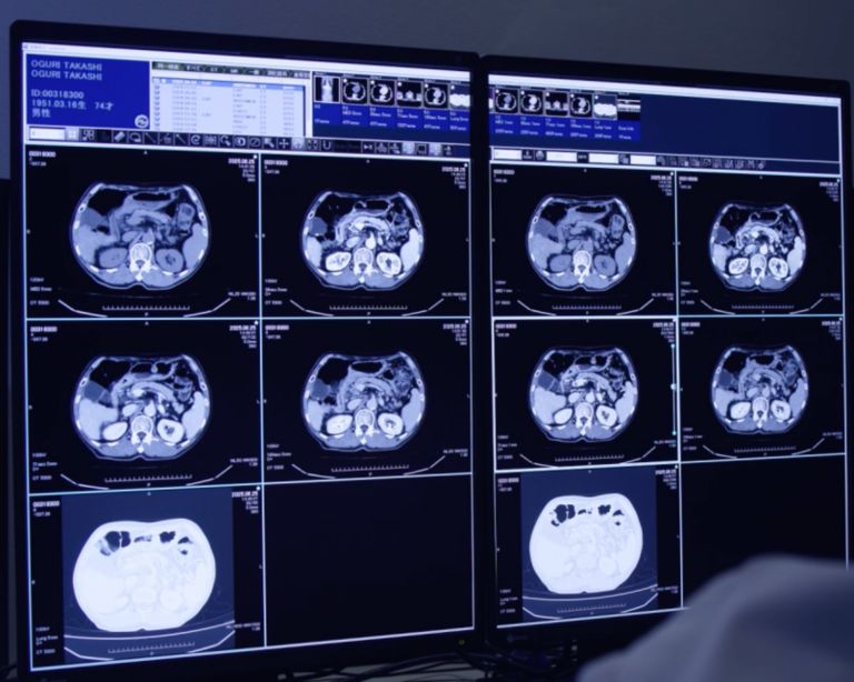 clinical image on screen