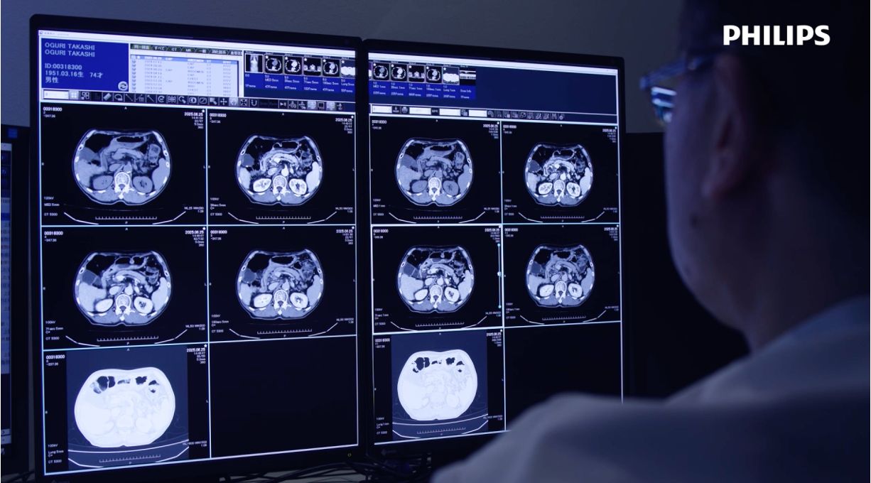 Vídeo que presenta la CT Philips 5300 en el Hospital de Iwata, Japón