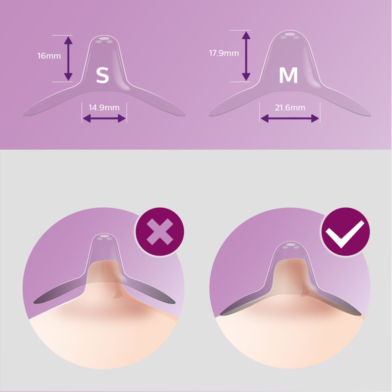 a reconstructed nipple before placement of foam nipple guard