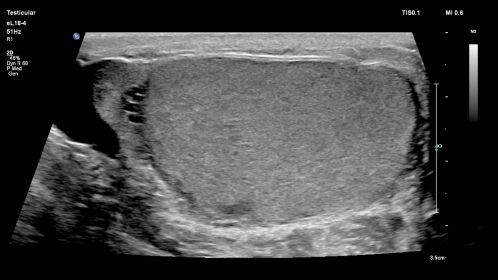 eL18-4 Testis