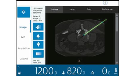 Automatic needle tracking