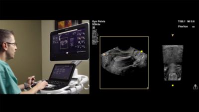 Philips Ultrasound FlexVue and FlexVue Volume Demonstration by Dr. Michael Ruma 