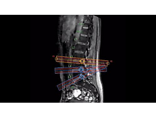 SmartExam Spine MR Clinical application