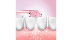 Hjälper till att förhindra hål i tänderna där det är svårt att komma åt