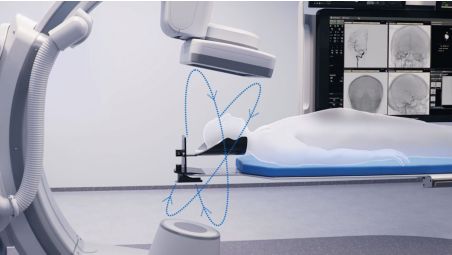 CBCT with helical acquisition​