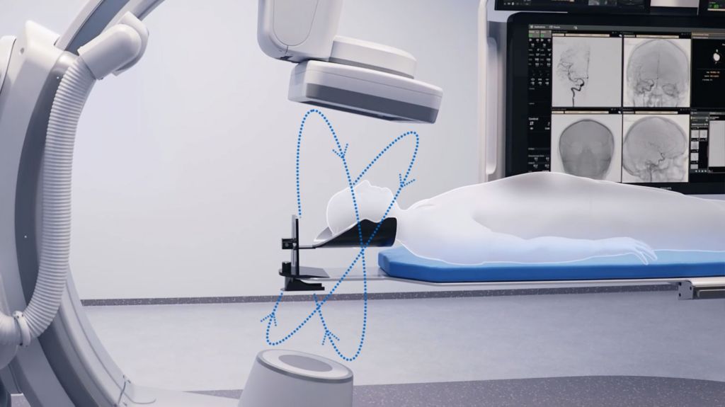 CBCT with helical acquisition​​